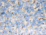 FCGRT Antibody Mouse Brain IHC. Immunohistochemistry testing of FFPE mouse brain with FCGRT antibody. HIER: Boil the paraffin sections in pH 6, 10mM citrate buffer for 20 minutes and allow to cool prior to staining.