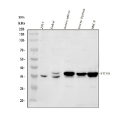 Western blot analysis of STING/TMEM173 Antibody. Proteins were resolved by 10% SDS-PAGE and transferred to a nitrocellulose membrane prior to immunodetection. Lane 1: human 293T whole cell lysates; Lane 2: human Jurkat whole cell lysates; Lane 3: mouse spleen tissue lysates; Lane 4: mouse thymus tissue lysates; Lane 5: mouse MH-S whole cell lysates. A prominent band corresponding to TMEM173 was detected at approximately 35 kDa across multiple samples. Although the predicted molecular weight of STING is approximately 42 kDa based on amino acid sequence, STING is well documented to migrate at a lower apparent molecular weight on SDS-PAGE, likely due to its multi-pass transmembrane architecture, hydrophobic regions, and detergent-dependent electrophoretic behavior. Lower apparent migration and subtle band heterogeneity have been reported for STING in both human and mouse tissues, and the observed banding pattern is consistent with published studies of endogenous TMEM173 expression.