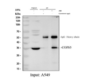 Immunoprecipitation of JAB1 protein from 500ug of human A549 whole cell lysate with 2ug of JAB1 antibody.
