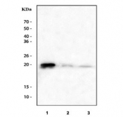 Western blot testing of 1) human A431, 2) rat PC-12 and 3) mouse brain tissue lysate with CIB1 antibody. Predicted molecular weight ~21 kDa.