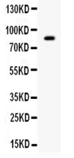 SMURF2 Antibody Human Liver Cancer Cell WB. Western blot testing of human SMMC cells using SMURF2 antibody detected a specific band at approximately 86 kDa, consistent with the expected molecular weight of SMURF2. The observed band confirms expression of this HECT-domain E3 ubiquitin ligase in human liver cancer cells. This SMURF2 Antibody, also called a SMAD Specific E3 Ubiquitin Protein Ligase 2 Antibody, is useful for investigating protein ubiquitination, TGF-beta signaling, signal transduction, and tumor biology.