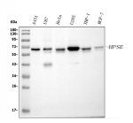 Heparanase 1 Antibody Human Cancer Cell WB. Western blot testing of human A431 (lane 1), U87 (lane 2), HeLa (lane 3), U2OS (lane 4), THP-1 (lane 5), and MCF-7 (lane 6) cell lysates using Heparanase 1 antibody detected a prominent band at approximately 61 kDa, consistent with the expected molecular weight of the mature active form of HPSE. Heparanase is synthesized as a latent precursor that undergoes proteolytic processing to generate the enzymatically active protein responsible for heparan sulfate degradation. This Heparanase 1 Antibody, also called an HPSE Antibody, is useful for investigating extracellular matrix remodeling, angiogenesis, inflammation, tumor invasion, and cancer progression.