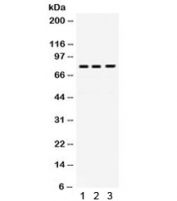 Western blot testing of 1) rat liver, 2) human HeLa and 3) human SW620 lysate with DNA polymerase eta antibody. Expected/observed molecular weight ~78 kDa.