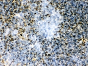 IHC-F: TGM2 antibody testing of mouse spleen tissue