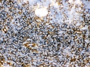 IHC-F: TGM2 antibody testing of rat spleen tissue