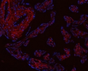 Collagen I Antibody Human Placenta IF. Immunofluorescent staining of FFPE human placental tissue with Collagen I antibody revealed strong extracellular and stromal staining consistent with the distribution of type I collagen within connective tissue compartments. Collagen I, composed primarily of COL1A1 and COL1A2 chains, is the most abundant fibrillar collagen in the extracellular matrix and provides structural support, tensile strength, and tissue integrity. Red fluorescence indicates Collagen I expression, while nuclei are counterstained with DAPI (blue). The prominent extracellular staining pattern observed in placental connective tissues is consistent with the essential role of collagen I in matrix organization, tissue architecture, and cell-matrix interactions. Heat-induced epitope retrieval was performed by steaming sections in pH 8 EDTA buffer for 20 minutes prior to immunostaining. These results support the utility of Collagen I Antibody for studies of extracellular matrix biology, tissue remodeling, fibrosis, and connective tissue development.