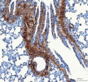Collagen I Antibody / Extracellular Matrix Protein Rat Lung IHC. Immunohistochemical staining of FFPE rat lung tissue using Collagen I Antibody / Extracellular Matrix Protein. Collagen I expression is observed predominantly within the connective tissue surrounding bronchioles and blood vessels, consistent with its role in maintaining pulmonary extracellular matrix architecture and providing structural support to the respiratory tract. Heat-induced epitope retrieval was performed by boiling tissue sections in pH 8 EDTA for 20 minutes followed by cooling prior to immunostaining.