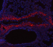 Collagen I Antibody Mouse Lung IF. Immunofluorescent staining of FFPE mouse lung tissue with Collagen I antibody revealed strong extracellular staining associated with connective tissue structures and alveolar septal regions, consistent with the distribution of type I collagen within the pulmonary extracellular matrix. Collagen I, composed primarily of COL1A1 and COL1A2 chains, is a major fibrillar collagen that provides structural support and mechanical stability to connective tissues. Red fluorescence indicates Collagen I expression, while nuclei are counterstained with DAPI (blue). The prominent staining pattern along stromal and matrix-rich regions is consistent with the role of collagen I in maintaining lung architecture and regulating tissue remodeling. Heat-induced epitope retrieval was performed by steaming sections in pH 8 EDTA buffer for 20 minutes prior to immunostaining. These results support the utility of Collagen I Antibody for studies of extracellular matrix biology, pulmonary fibrosis, tissue remodeling, and connective tissue development.