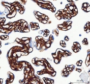 Collagen I Antibody / Extracellular Matrix Protein Human Placenta IHC. Immunohistochemical staining of FFPE human placental tissue using Collagen I Antibody / Extracellular Matrix Protein. Collagen I expression is observed predominantly within the placental stromal extracellular matrix, consistent with its role in providing structural support and maintaining tissue integrity during placental development. Heat-induced epitope retrieval was performed by boiling tissue sections in pH 8 EDTA for 20 minutes followed by cooling prior to immunostaining.
