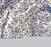 IHC staining of FFPE human tonsil tissue with CD33 antibody, HRP-secondary and DAB substrate. HIER: boil tissue sections in pH8 EDTA for 20 min and allow to cool before testing.