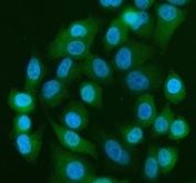 YAP1 Antibody IF. Immunofluorescent staining demonstrates YAP1 expression in FFPE human A549 cells using a YAP1 antibody (green) with DAPI nuclear counterstain (blue). YAP1, a key Hippo pathway effector, is observed in both the cytoplasm and nuclei of A549 cells, consistent with its role as a transcriptional coactivator that shuttles between cellular compartments. Heat induced epitope retrieval was performed by steaming sections in pH6 citrate buffer for 20 minutes prior to staining. This immunofluorescence assay highlights the intracellular distribution of Yes Associated Protein 1 and supports the utility of the antibody for studies of Hippo signaling, mechanotransduction, and cancer biology.