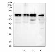 YAP1 Antibody Human and Rat WB. Western blot analysis of YAP1 expression using a YAP1 antibody. Lane 1: human HepG2 cell lysate. Lane 2: human RT4 cell lysate. Lane 3: human PC-3 cell lysate. Lane 4: mouse RM1 cell lysate. YAP1, also known as Yes Associated Protein 1, is a transcriptional coactivator and major Hippo pathway effector involved in cell proliferation, tissue growth, and tumorigenesis. A strong band is detected in all lysates at approximately 65 to 70 kDa, consistent with the commonly observed electrophoretic mobility of YAP1. Although the predicted molecular weight is approximately 54 kDa, post translational modifications and phosphorylation are known to cause slower migration in SDS PAGE. These results support the utility of YAP1 Antibody for detecting endogenous YAP1 across multiple cell types and species.
