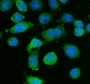 Caldesmon Antibody for IF / CALD1 Immunofluorescence Antibody. Immunofluorescence analysis of Caldesmon (CALD1) in human SiHa cells. FFPE human SiHa cells stained with Caldesmon Antibody for IF / CALD1 Immunofluorescence Antibody show strong green cytoplasmic fluorescence with a filamentous, fiber-like staining pattern consistent with actin-associated cytoskeletal organization. The fluorescence signal highlights elongated cellular morphology and cytoplasmic filament networks surrounding the nuclei. Nuclei are counterstained with DAPI (blue). Heat-induced epitope retrieval was performed using pH6 citrate buffer.