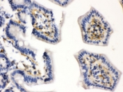 IHC testing of FFPE mouse intestine with Caldesmon antibody. HIER: Boil the paraffin sections in pH8 EDTA buffer for 20 minutes and allow to cool prior to testing.
