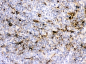 Alpha A Crystallin Antibody Rat Spleen IHC. IHC staining of FFPE rat spleen with Alpha A Crystallin antibody demonstrated cytoplasmic staining in scattered splenic cells. Alpha A Crystallin (CRYAA) is a small heat shock protein and ATP-independent molecular chaperone that protects cells from protein aggregation, oxidative stress, and apoptosis while maintaining protein homeostasis. Although predominantly expressed in the ocular lens, Alpha A Crystallin is also present in selected non-lenticular tissues where it contributes to cellular stress responses and cytoprotection. HIER was performed by boiling tissue sections in pH 6, 10 mM citrate buffer for 20 minutes followed by cooling prior to staining. These results support the utility of Alpha A Crystallin Antibody for studies of molecular chaperone function, protein homeostasis, and cellular stress responses.