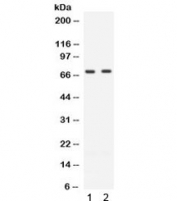 ZAP70 Antibody for WB / Phosphorylation Signaling Western Blot Antibody. Western blot analysis of Lane 1: human Jurkat cell lysate, Lane 2: human CEM cell lysate using ZAP70 Antibody for WB / Phosphorylation Signaling Western Blot Antibody. A band is detected at approximately 70 kDa, consistent with the predicted molecular weight of Zeta-chain-associated protein kinase 70 (ZAP70), a phosphorylation-regulated tyrosine kinase central to T-cell receptor signaling. Comparable band intensity across both T-cell leukemia lines supports consistent expression of ZAP70, while its known phosphorylation-dependent regulation makes it a key target for studying signaling activation and kinase modulation by western blot.