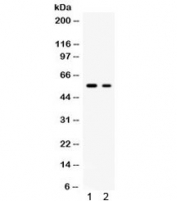 SLC2A5 Antibody Rat Brain and K562 WB. Western blot analysis of SLC2A5 expression using an SLC2A5 antibody. Lane 1: rat brain lysate. Lane 2: human K562 cell lysate. SLC2A5, also known as GLUT5 and Sugar Transport Protein, is a facilitative transporter that preferentially mediates fructose uptake and contributes to cellular energy metabolism. A prominent band is detected at approximately 55 kDa in both samples, consistent with the expected molecular weight of SLC2A5. These results demonstrate endogenous expression of this nutrient transporter in rodent and human tissues and support the utility of SLC2A5 Antibody for studies of fructose transport, carbohydrate metabolism, and metabolic regulation.