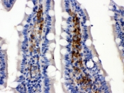 SLC2A5 Antibody Rat Intestine IHC. Immunohistochemical staining of FFPE rat intestine demonstrates SLC2A5 expression using an SLC2A5 antibody. SLC2A5, also known as GLUT5 and Sugar Transport Protein, is a facilitative transporter that preferentially mediates fructose uptake and plays a central role in intestinal carbohydrate absorption. Predominantly apical and cytoplasmic staining is observed in intestinal epithelial cells, consistent with the localization of GLUT5 in enterocytes responsible for dietary fructose transport. Heat induced epitope retrieval was performed by boiling tissue sections in pH 6 10 mM citrate buffer for 20 minutes followed by cooling prior to staining. These results support the utility of SLC2A5 Antibody for studies of fructose transport, nutrient absorption, and metabolic regulation.