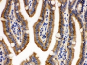 CDCP1 Antibody / SIMA135 immunohistochemistry analysis of mouse intestine tissue. Formalin-fixed paraffin-embedded mouse intestine stained with CDCP1 Antibody / SIMA135. HRP-DAB brown chromogenic staining highlights membranous signal along intestinal epithelial cells lining the villi, consistent with the expected cell surface localization of CDCP1 / CD318. HIER: boil the paraffin sections in pH 6, 10mM citrate buffer for 20 minutes and allow to cool prior to testing.