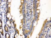 CDCP1 Antibody / SIMA135 immunohistochemistry analysis of rat intestine tissue. Formalin-fixed paraffin-embedded rat intestine stained with CDCP1 Antibody / SIMA135. HRP-DAB brown chromogenic staining highlights membranous signal in intestinal epithelial cells lining the villi, consistent with the expected cell surface localization of CDCP1 / CD318. HIER: boil the paraffin sections in pH 6, 10mM citrate buffer for 20 minutes and allow to cool prior to testing.