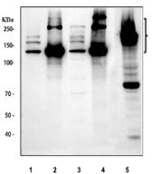 Collagen I Antibody Rodent Tissues and Fibroblasts WB. Western blot analysis of Collagen I expression was performed using anti-Collagen I antibody in rodent tissue and cell lysates. Lane 1: rat lung lysate. Lane 2: rat skin lysate. Lane 3: mouse lung lysate. Lane 4: mouse skin lysate. Lane 5: mouse NIH 3T3 cell lysate. Collagen I is the major fibrillar collagen of connective tissues and is synthesized as a high-molecular-weight procollagen precursor that undergoes proteolytic processing to generate mature collagen chains. Prominent immunoreactive bands are detected between approximately 140-210 kDa, corresponding to precursor procollagen forms, with additional bands observed in the expected mature collagen range of approximately 70-90 kDa. Strong expression in skin tissues and NIH 3T3 fibroblasts is consistent with the abundant production of type I collagen by fibroblasts and connective tissue cells. These results support the utility of Collagen I Antibody for studies of extracellular matrix biology, fibrosis, connective tissue development, wound healing, and tissue remodeling.