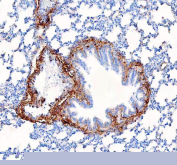 Collagen I Antibody Rat Lung IHC. IHC staining of FFPE rat lung tissue with Collagen I antibody demonstrated strong extracellular staining surrounding bronchiolar structures, vascular walls, and connective tissue-rich stromal regions, consistent with the distribution of type I collagen within the pulmonary extracellular matrix. Collagen I is the principal fibrillar collagen responsible for providing tensile strength, structural support, and mechanical stability to connective tissues. The prominent staining observed around airway and perivascular structures highlights the role of collagen I in maintaining lung architecture and extracellular matrix organization. Immunostaining was performed using an HRP-conjugated secondary antibody and DAB chromogen. Heat-induced epitope retrieval was achieved by boiling tissue sections in pH 8 EDTA buffer for 20 minutes and allowing them to cool before testing. These results support the utility of Collagen I Antibody for studies of extracellular matrix biology, pulmonary fibrosis, tissue remodeling, and connective tissue development.