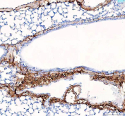 Collagen I Antibody Mouse Lung IHC. IHC staining of FFPE mouse lung tissue with Collagen I antibody demonstrated strong extracellular staining along alveolar walls, peribronchial connective tissue, and vascular-associated stromal structures, consistent with the distribution of type I collagen within the pulmonary extracellular matrix. Collagen I is the principal fibrillar collagen responsible for providing tensile strength, structural support, and mechanical integrity to connective tissues. The prominent staining observed within matrix-rich regions surrounding airways and blood vessels highlights the essential role of collagen I in maintaining normal lung architecture and extracellular matrix organization. Immunostaining was performed using an HRP-conjugated secondary antibody and DAB chromogen. Heat-induced epitope retrieval was achieved by boiling tissue sections in pH 8 EDTA buffer for 20 minutes and allowing them to cool before testing. These results support the utility of Collagen I Antibody for studies of extracellular matrix biology, pulmonary fibrosis, tissue remodeling, and connective tissue development.