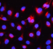 Immunofluorescent staining of FFPE human A549 cells with Alpha Internexin antibody (red) and DAPI nuclear stain (blue). HIER: steam section in pH6 citrate buffer for 20 min.