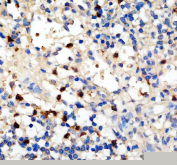 Platelet Factor 4 Antibody Human Spleen IHC. Immunohistochemistry staining of FFPE human spleen tissue with Platelet Factor 4 Antibody. HIER was performed using pH 8 EDTA buffer for 20 minutes prior to staining. The tissue section was incubated with Platelet Factor 4 antibody, followed by HRP-conjugated secondary antibody and DAB chromogen detection. Platelet Factor 4 Antibody / Platelet Alpha Granule Protein Antibody demonstrates staining consistent with PF4 expression in platelet-associated cells and megakaryocyte lineage populations, supporting studies of platelet alpha granules, platelet activation and hematology-related immune signaling pathways.