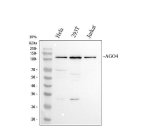 AGO4 Antibody Human Cell Line WB. Western blot analysis of human cell lysates using AGO4 Antibody / RNA Silencing Protein Antibody. Lane 1: HeLa cells; Lane 2: 293T cells; Lane 3: Jurkat cells. A specific band is detected at approximately 100 kDa, consistent with the expected molecular weight of AGO4 at approximately 97 kDa. These results support the use of AGO4 Antibody / RNA Silencing Protein Antibody for studying Argonaute family proteins, RNA silencing pathways and microRNA-mediated gene regulation.