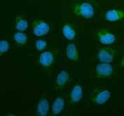 Immunofluorescent staining of FFPE human U-2 OS cells with AIRE antibody (green) and DAPI nuclear stain (blue). HIER: steam section in pH6 citrate buffer for 20 min.