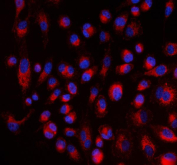 Immunofluorescent staining of FFPE human PC-3 cells with ALDH1A2 antibody (red) and DAPI nuclear stain (blue). HIER: steam section in pH6 citrate buffer for 20 min.