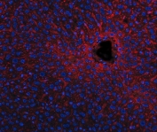 Apolipoprotein E Antibody Mouse Liver IF. Immunofluorescent staining of FFPE mouse liver tissue with Apolipoprotein E antibody (red). Heat-induced epitope retrieval (HIER) was performed by steaming sections in pH 8 EDTA buffer for 20 minutes prior to staining. Nuclei are counterstained with DAPI (blue). Apolipoprotein E immunoreactivity is observed predominantly within the cytoplasm of hepatocytes and along hepatic sinusoidal structures, consistent with the expected localization of this lipid transport protein involved in cholesterol homeostasis and lipoprotein metabolism.