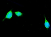 Apolipoprotein E Antibody Mouse HEPA1-6 Cell IF. Immunofluorescent staining of FFPE mouse HEPA1-6 cells with Apolipoprotein E antibody (green). Heat-induced epitope retrieval (HIER) was performed by steaming sections in pH 6 citrate buffer for 20 minutes prior to staining. Nuclei are counterstained with DAPI (blue). Apolipoprotein E immunoreactivity is observed predominantly within the cytoplasm of HEPA1-6 cells, consistent with the expected localization of this lipid transport protein involved in cholesterol homeostasis and lipoprotein metabolism.