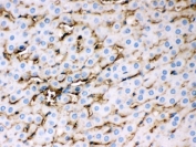 APOE Antibody Rat Liver IHC. Immunohistochemical staining of FFPE rat liver tissue with APOE antibody at 1 ug/ml. Heat-induced epitope retrieval (HIER) was performed by steaming tissue sections in pH 6 citrate buffer and allowing them to cool prior to staining. APOE immunoreactivity is observed predominantly within the cytoplasm of hepatocytes and along hepatic sinusoidal structures, consistent with the expected localization of this lipid transport protein involved in cholesterol homeostasis and lipoprotein metabolism. Cell nuclei are counterstained with hematoxylin (blue).