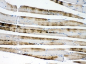 IHC testing of FFPE rat skeletal muscle with ACTN3 antibody at 1ug/ml. HIER: steam sections in pH6 citrate buffer for 20 min.