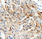 IHC staining of FFPE mouse heart tissue with AK1 antibody. HIER: boil tissue sections in pH8 EDTA for 20 min and allow to cool before testing.