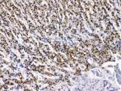AKR1B1 Antibody Rat Adrenal Gland IHC. Immunohistochemistry testing of FFPE rat adrenal gland with AKR1B1 antibody at 1ug/ml. HIER: steam sections in pH6 citrate buffer for 20 min.