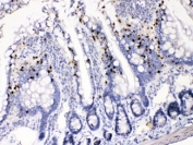 AKR1B1 Antibody Rat Intestine Gland IHC. Immunohistochemistry testing of FFPE rat intestine with AKR1B1 antibody at 1ug/ml. HIER: steam sections in pH6 citrate buffer for 20 min.