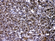 IHC testing of FFPE mouse lymph tissue with ARHGEF1 antibody at 1ug/ml. HIER: steam sections in pH6 citrate buffer for 20 min.