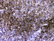 Immunohistochemistry of CD40 antibody in FFPE mouse spleen tissue. Mouse spleen shows strong membranous and cytoplasmic HRP-DAB brown staining in lymphoid cells within splenic follicles and periarteriolar lymphoid regions, consistent with CD40 expression in B lymphocytes and antigen-presenting cells. This CD40 Antibody Rabbit Polyclonal was applied at 1 ug/ml following heat-induced epitope retrieval by steaming sections in pH 6 citrate buffer for 20 minutes prior to staining.