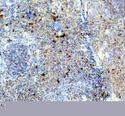 IHC staining of FFPE mouse spleen tissue with TCP1 antibody, HRP-labeled secondary and DAB substrate. HIER: boil tissue sections in pH8 EDTA for 20 min and allow to cool before testing.