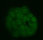 SAFB Antibody T47D Cell IF. Immunofluorescence staining of T47D cells with SAFB Antibody demonstrated predominant nuclear localization with a punctate staining pattern characteristic of nuclear speckles involved in RNA processing and transcriptional regulation. Cells underwent enzyme-mediated antigen retrieval before incubation with the primary antibody and a Fluoro488-conjugated secondary antibody. The observed staining is consistent with the function of SAFB as a Scaffold Attachment Factor that associates with chromatin and nuclear RNA-processing complexes. This SAFB Antibody, a Scaffold Attachment Factor Antibody, is suitable for immunofluorescence studies of nuclear organization, gene regulation and RNA metabolism.
