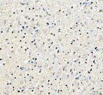 SAFB Antibody Mouse Brain IHC. Immunohistochemical staining of FFPE mouse brain demonstrated widespread SAFB expression with prominent nuclear staining in neurons and other brain cells, accompanied by weaker diffuse cytoplasmic staining. Heat-induced epitope retrieval was performed in pH8 EDTA buffer before staining with the primary antibody and HRP-DAB detection. The predominantly nuclear localization is consistent with the role of Scaffold Attachment Factor in chromatin organization, transcriptional regulation and RNA processing within the central nervous system. This SAFB Antibody, a Scaffold Attachment Factor Antibody, is suitable for immunohistochemical studies of neuronal gene regulation and brain tissue biology.