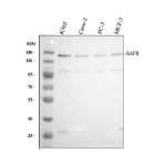 SAFB Antibody Human Cancer Cell WB. Western blot analysis detected SAFB in human K562 (lane 1), Caco-2 (lane 2), PC-3 (lane 3) and MCF-7 (lane 4) cell lysates. A predominant immunoreactive band was observed at approximately 150 kDa, migrating higher than the predicted molecular weight of about 103 kDa, consistent with the reduced electrophoretic mobility reported for this multifunctional nuclear protein. SAFB is known to undergo extensive post-translational modification and participate in large nuclear protein complexes, which can influence its apparent migration. This SAFB Antibody, a Scaffold Attachment Factor Antibody, is suitable for detecting endogenous SAFB in studies of transcriptional regulation, chromatin organization and RNA processing.