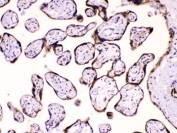 IHC testing of FFPE human placenta tissue with Calpastatin antibody at 1ug/ml. HIER: steam section in pH6 citrate buffer for 20 min.