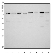 Western blot testing of 1) human HeLa, 2) human PC-3, 3) human A431, 4) human K562, 5) rat liver, 6) rat PC-12, 7) mouse liver and 8) mouse SP2/0 cell lysate with MUT antibody. Predicted molecular weight ~83 kDa.