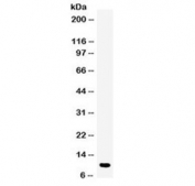 DBI Antibody Human Placenta WB. Western blot analysis of human placenta lysate using DBI antibody detects a prominent band at approximately 10 kDa, consistent with the predicted molecular weight of DBI / Diazepam binding inhibitor, a lipid-binding protein involved in acyl-CoA transport, neurosteroid regulation, and intracellular metabolic signaling.