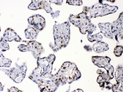 DBI Antibody Human Placenta IHC. Immunohistochemistry of FFPE human placenta tissue using DBI antibody demonstrates granular HRP-DAB brown cytoplasmic staining in placental trophoblast-associated cells, consistent with DBI / Diazepam binding inhibitor expression linked to intracellular lipid metabolism, steroid-associated signaling, and acyl-CoA-binding activity. HIER: steam sections in pH6 citrate buffer for 20 min.