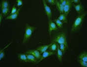 DBI Antibody U-2 OS IF. Immunofluorescence analysis of FFPE human U-2 OS cells using DBI antibody (green) demonstrates diffuse cytoplasmic staining consistent with DBI / Diazepam binding inhibitor localization associated with intracellular lipid metabolism and acyl-CoA-binding activity, while nuclei are counterstained with DAPI (blue). HIER: steam sections in pH6 citrate buffer for 20 min.